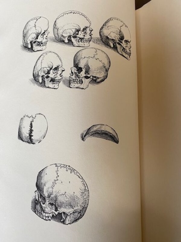 Andreae Vesalii Bruxellensis Icones anatomicae